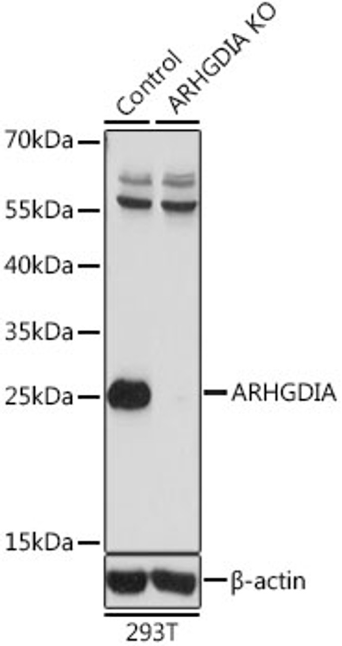 Western blot analysis of extracts from normal (control) and ARHGDIA knockout (KO) 293T cells, using ARHGDIA antibody (14-275) at 1:1000 dilution.<br/>Secondary antibody: HRP Goat Anti-Rabbit IgG (H+L) at 1:10000 dilution.<br/>Lysates/proteins: 25ug per lane.<br/>Blocking buffer: 3% nonfat dry milk in TBST.<br/>Detection: ECL Basic Kit.<br/>Exposure time: 10s.