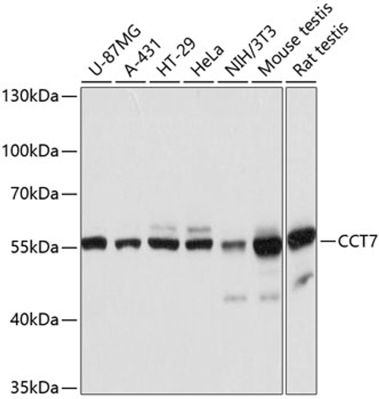 Western blot analysis of extracts of various cell lines, using CCT7 antibody (14-278) at 1:3000 dilution.<br/>Secondary antibody: HRP Goat Anti-Rabbit IgG (H+L) at 1:10000 dilution.<br/>Lysates/proteins: 25ug per lane.<br/>Blocking buffer: 3% nonfat dry milk in TBST.<br/>Detection: ECL Basic Kit.<br/>Exposure time: 1s.