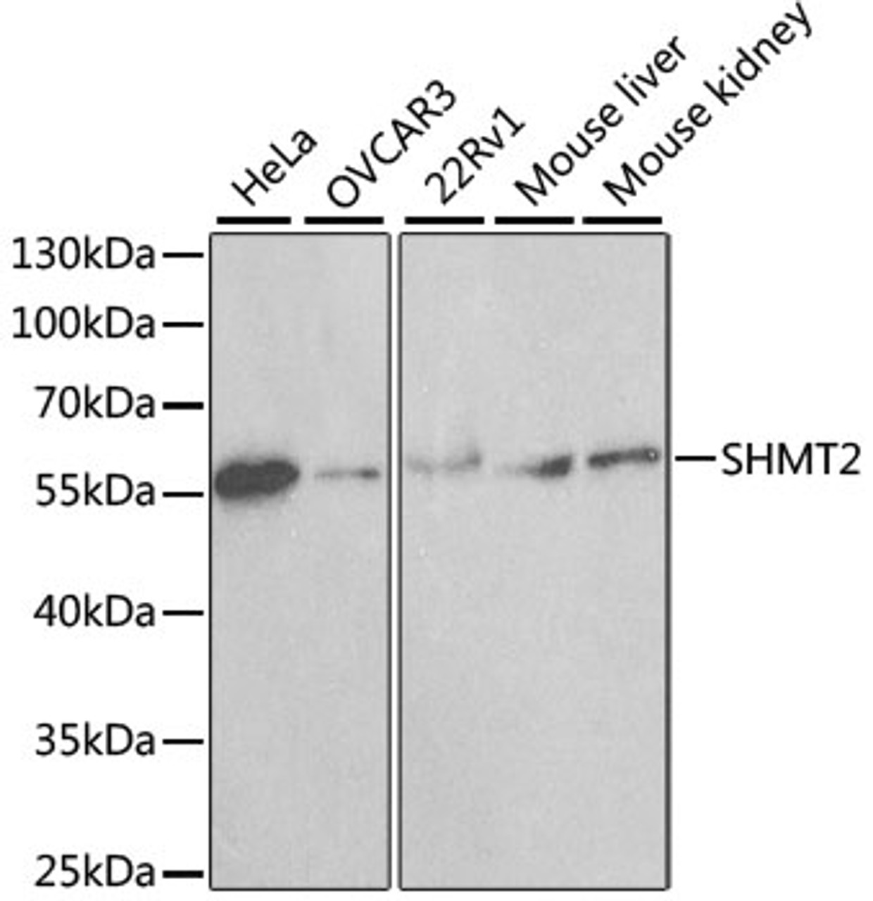 Western blot analysis of extracts of various cell lines, using SHMT2 antibody (14-280) at 1:1000 dilution.<br/>Secondary antibody: HRP Goat Anti-Rabbit IgG (H+L) at 1:10000 dilution.<br/>Lysates/proteins: 25ug per lane.<br/>Blocking buffer: 3% nonfat dry milk in TBST.<br/>Detection: ECL Basic Kit.
