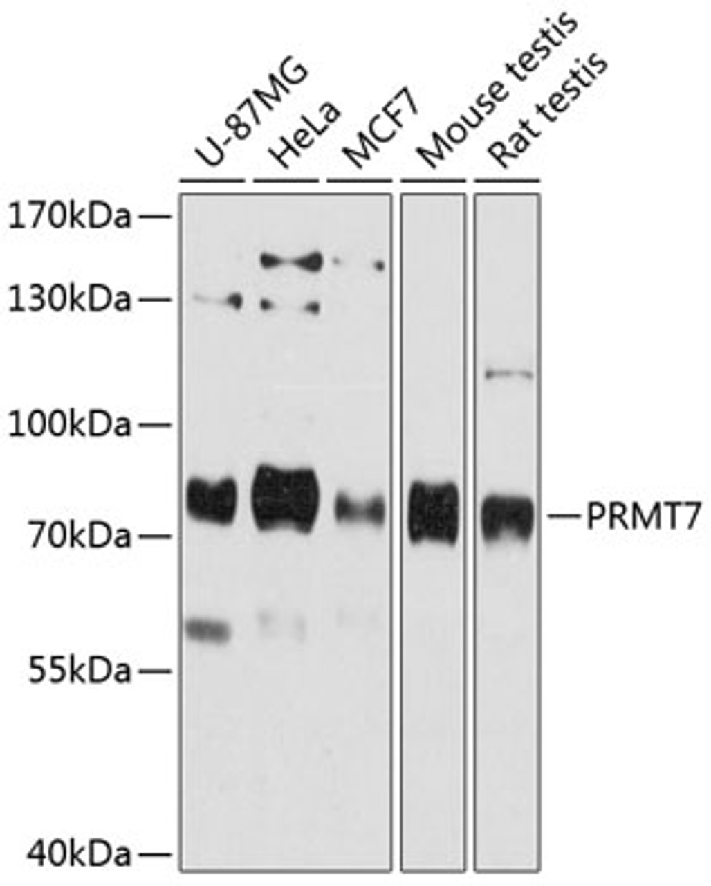 Western blot analysis of extracts of various cell lines, using PRMT7 antibody (14-285) at 1:3000 dilution.<br/>Secondary antibody: HRP Goat Anti-Rabbit IgG (H+L) at 1:10000 dilution.<br/>Lysates/proteins: 25ug per lane.<br/>Blocking buffer: 3% nonfat dry milk in TBST.<br/>Detection: ECL Basic Kit.<br/>Exposure time: 90s.