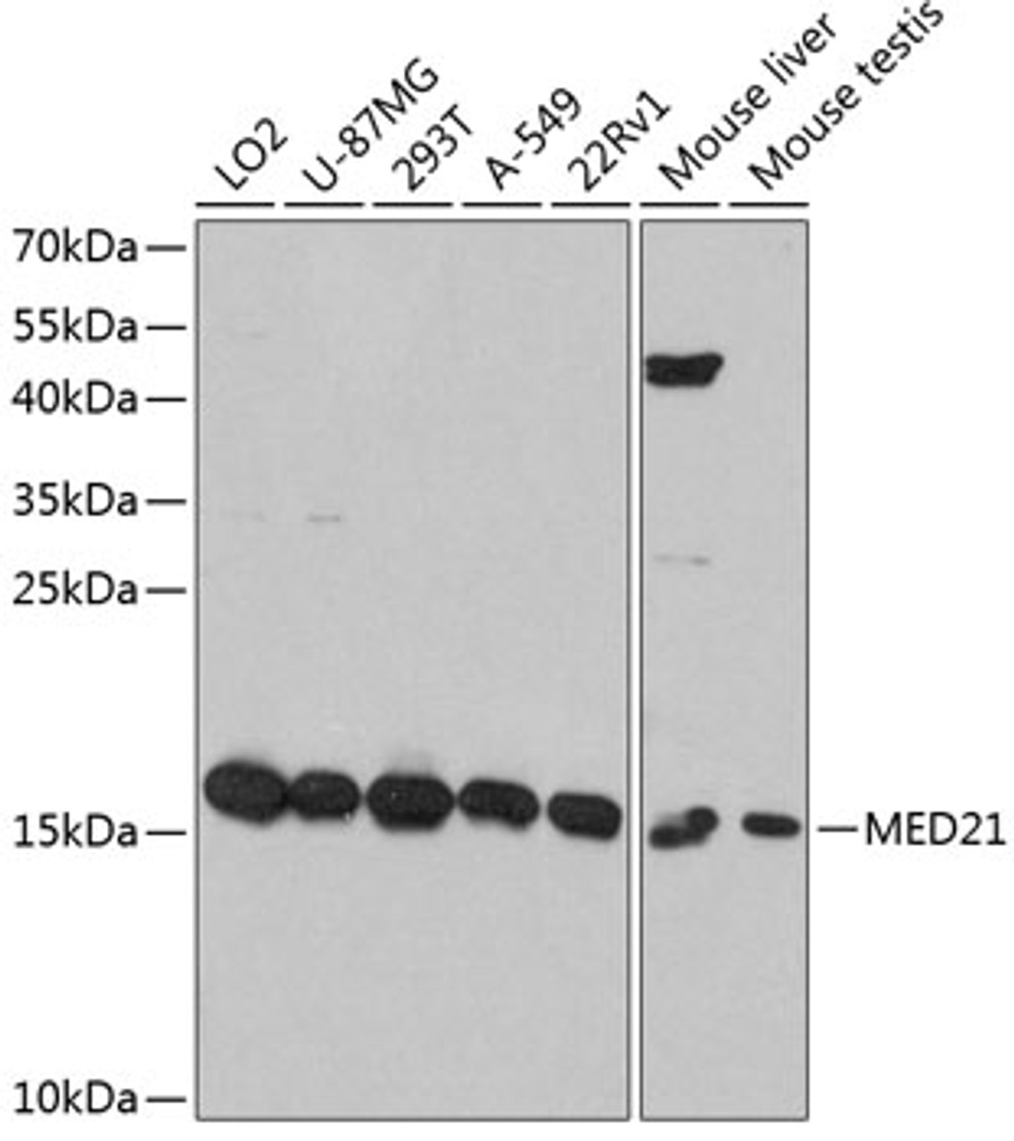 Western blot analysis of extracts of various cell lines, using MED21 antibody (14-291) at 1:3000 dilution.<br/>Secondary antibody: HRP Goat Anti-Rabbit IgG (H+L) at 1:10000 dilution.<br/>Lysates/proteins: 25ug per lane.<br/>Blocking buffer: 3% nonfat dry milk in TBST.<br/>Detection: ECL Basic Kit.<br/>Exposure time: 60s.