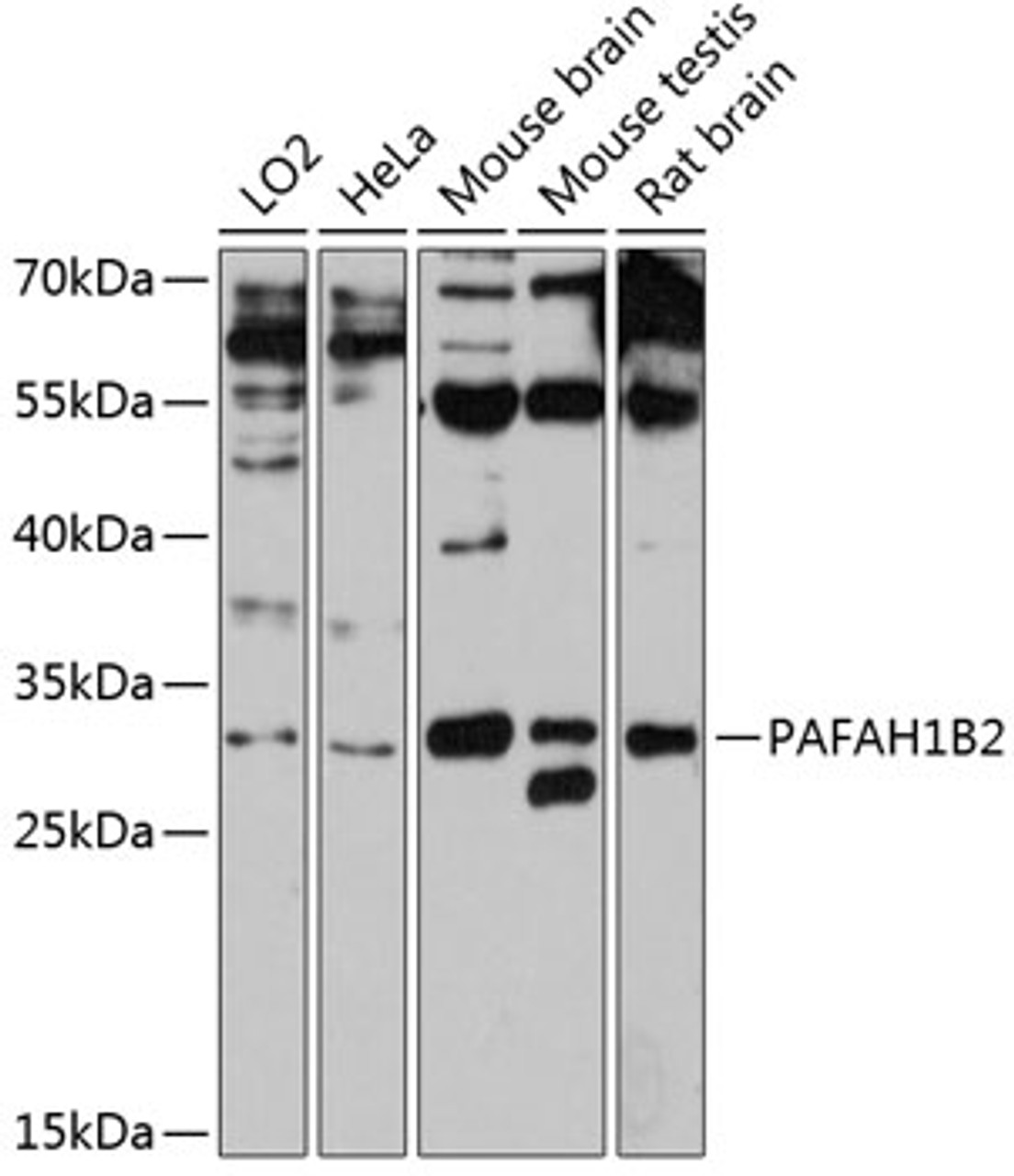Western blot analysis of extracts of various cell lines, using PAFAH1B2 antibody (14-293) at 1:3000 dilution.<br/>Secondary antibody: HRP Goat Anti-Rabbit IgG (H+L) at 1:10000 dilution.<br/>Lysates/proteins: 25ug per lane.<br/>Blocking buffer: 3% nonfat dry milk in TBST.<br/>Detection: ECL Enhanced Kit.<br/>Exposure time: 30s.