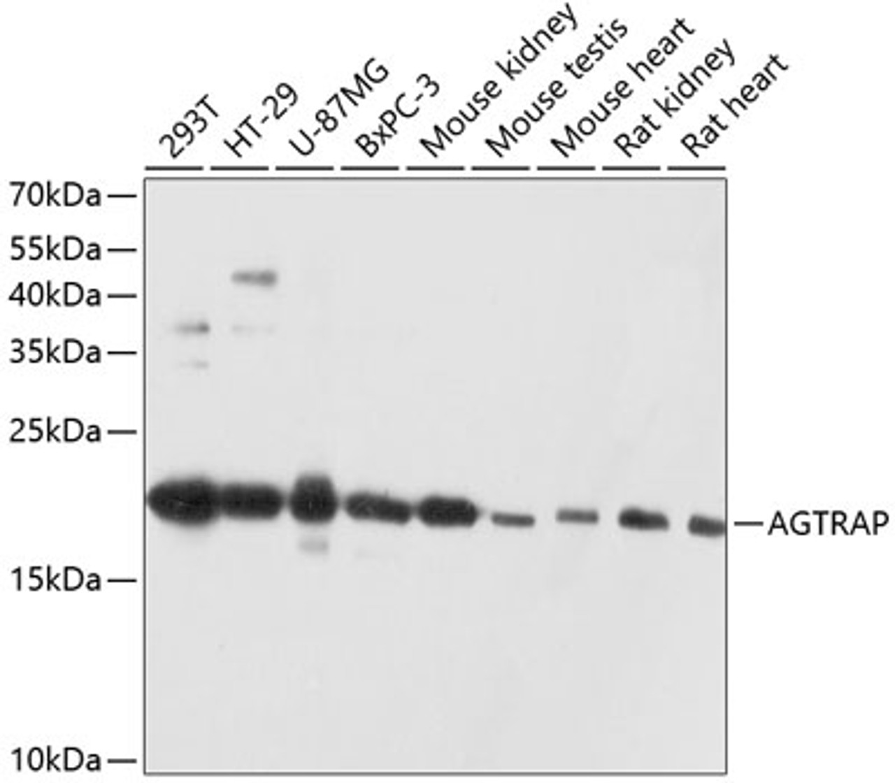 Western blot analysis of extracts of various cell lines, using AGTRAP antibody (14-297) at 1:3000 dilution.<br/>Secondary antibody: HRP Goat Anti-Rabbit IgG (H+L) at 1:10000 dilution.<br/>Lysates/proteins: 25ug per lane.<br/>Blocking buffer: 3% nonfat dry milk in TBST.<br/>Detection: ECL Basic Kit.<br/>Exposure time: 10s.