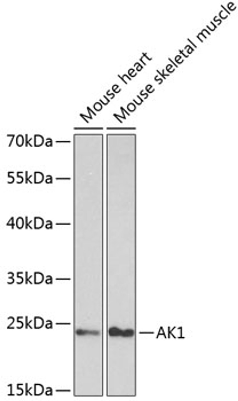 Western blot analysis of extracts of various cell lines, using AK1 antibody (14-299) at 1:1000 dilution.<br/>Secondary antibody: HRP Goat Anti-Rabbit IgG (H+L) at 1:10000 dilution.<br/>Lysates/proteins: 25ug per lane.<br/>Blocking buffer: 3% nonfat dry milk in TBST.