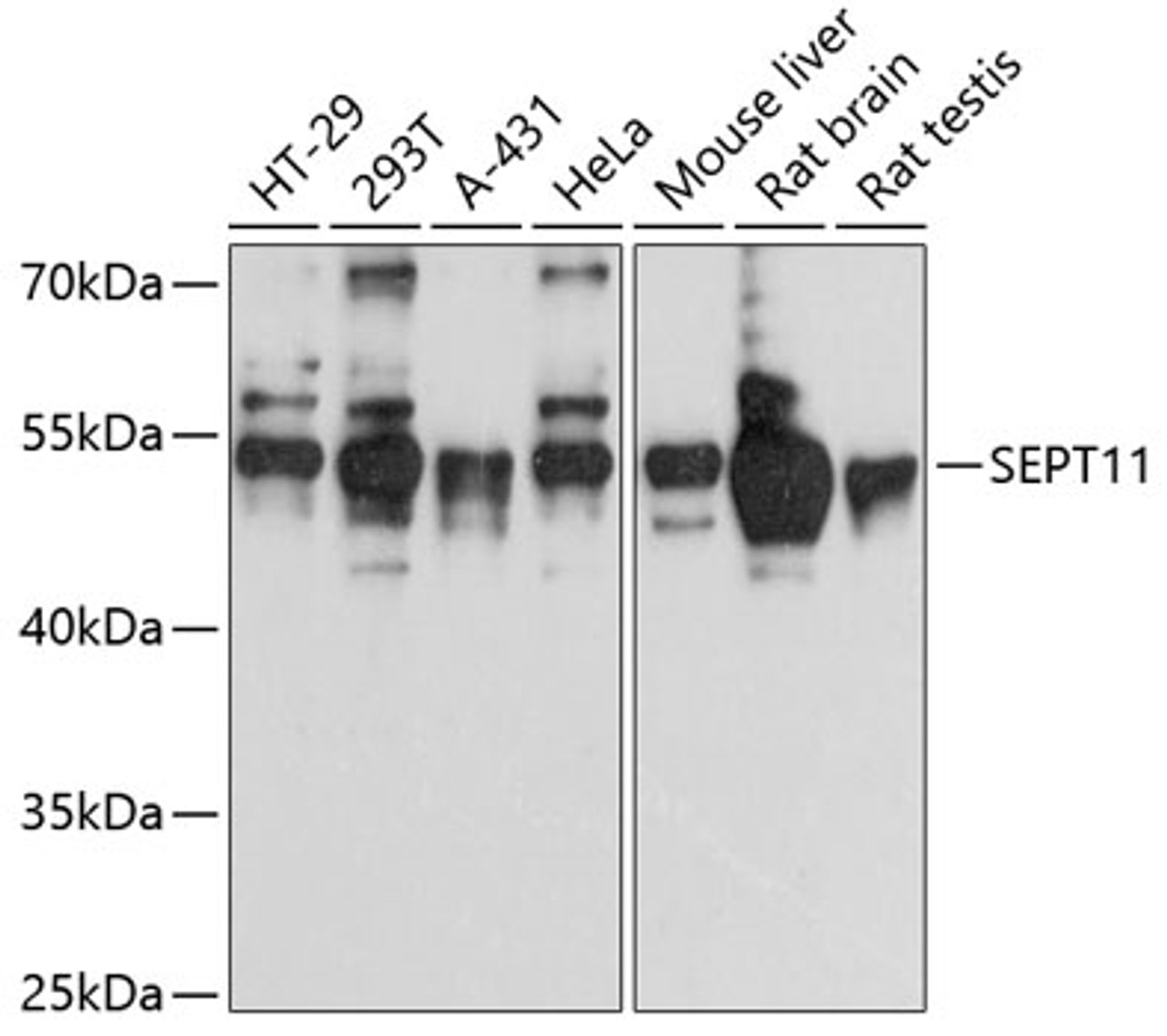 Western blot analysis of extracts of various cell lines, using SEPT11 antibody (14-302) at 1:3000 dilution.<br/>Secondary antibody: HRP Goat Anti-Rabbit IgG (H+L) at 1:10000 dilution.<br/>Lysates/proteins: 25ug per lane.<br/>Blocking buffer: 3% nonfat dry milk in TBST.<br/>Detection: ECL Basic Kit.<br/>Exposure time: 10s.