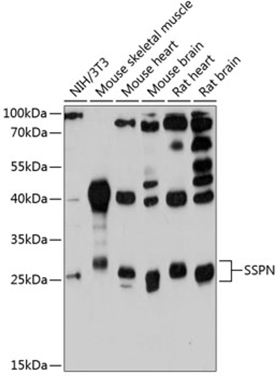Western blot analysis of extracts of various cell lines, using SSPN antibody (14-304) at 1:3000 dilution.<br/>Secondary antibody: HRP Goat Anti-Rabbit IgG (H+L) at 1:10000 dilution.<br/>Lysates/proteins: 25ug per lane.<br/>Blocking buffer: 3% nonfat dry milk in TBST.<br/>Detection: ECL Basic Kit.<br/>Exposure time: 90s.