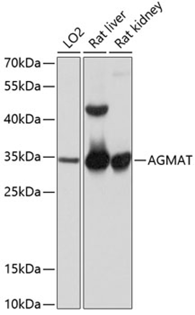 Western blot analysis of extracts of various cell lines, using AGMAT antibody (14-305) at 1:1000 dilution.<br/>Secondary antibody: HRP Goat Anti-Rabbit IgG (H+L) at 1:10000 dilution.<br/>Lysates/proteins: 25ug per lane.<br/>Blocking buffer: 3% nonfat dry milk in TBST.<br/>Detection: ECL Basic Kit.<br/>Exposure time: 1s.