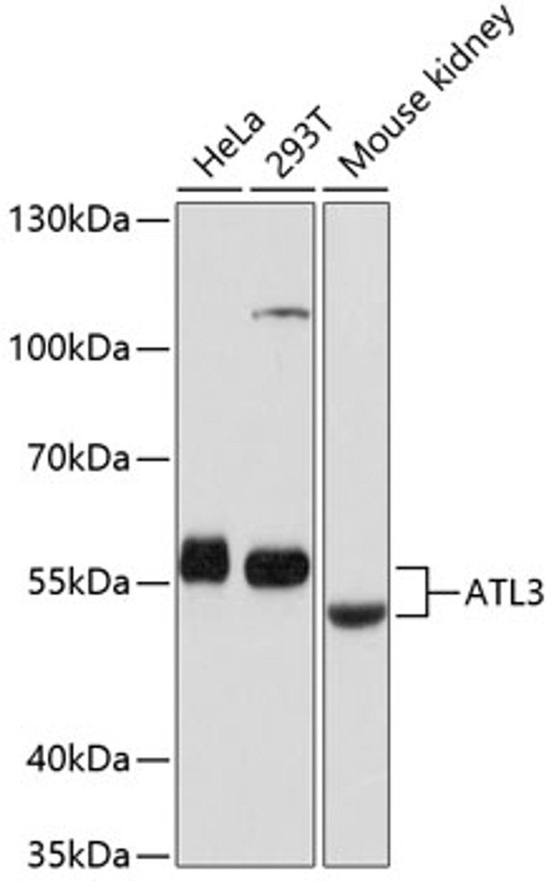 Western blot analysis of extracts of various cell lines, using ATL3 antibody (14-307) at 1:1000 dilution.<br/>Secondary antibody: HRP Goat Anti-Rabbit IgG (H+L) at 1:10000 dilution.<br/>Lysates/proteins: 25ug per lane.<br/>Blocking buffer: 3% nonfat dry milk in TBST.<br/>Detection: ECL Basic Kit.<br/>Exposure time: 1s.