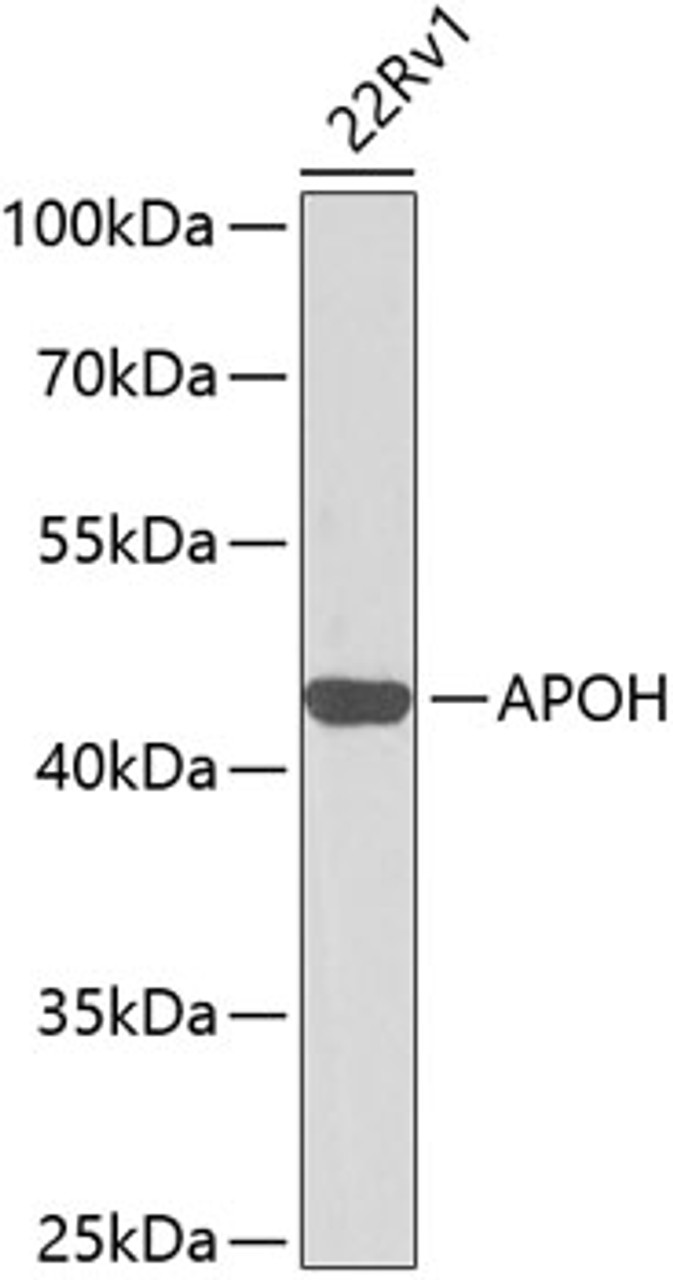 Western blot analysis of extracts of 22Rv1 cells, using APOH antibody (14-311) at 1:1000 dilution.<br/>Secondary antibody: HRP Goat Anti-Rabbit IgG (H+L) at 1:10000 dilution.<br/>Lysates/proteins: 25ug per lane.<br/>Blocking buffer: 3% nonfat dry milk in TBST.<br/>Detection: ECL Basic Kit.<br/>Exposure time: 30s.