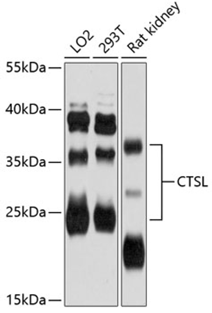 Western blot analysis of extracts of various cell lines, using CTSL antibody (14-312) at 1:3000 dilution.<br/>Secondary antibody: HRP Goat Anti-Rabbit IgG (H+L) at 1:10000 dilution.<br/>Lysates/proteins: 25ug per lane.<br/>Blocking buffer: 3% nonfat dry milk in TBST.<br/>Detection: ECL Basic Kit.<br/>Exposure time: 60s.