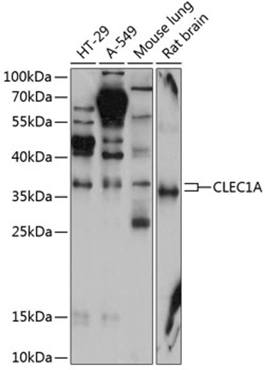 Western blot analysis of extracts of various cell lines, using CLEC1A antibody (14-315) at 1:1000 dilution.<br/>Secondary antibody: HRP Goat Anti-Rabbit IgG (H+L) at 1:10000 dilution.<br/>Lysates/proteins: 25ug per lane.<br/>Blocking buffer: 3% nonfat dry milk in TBST.<br/>Detection: ECL Enhanced Kit.<br/>Exposure time: 90s.