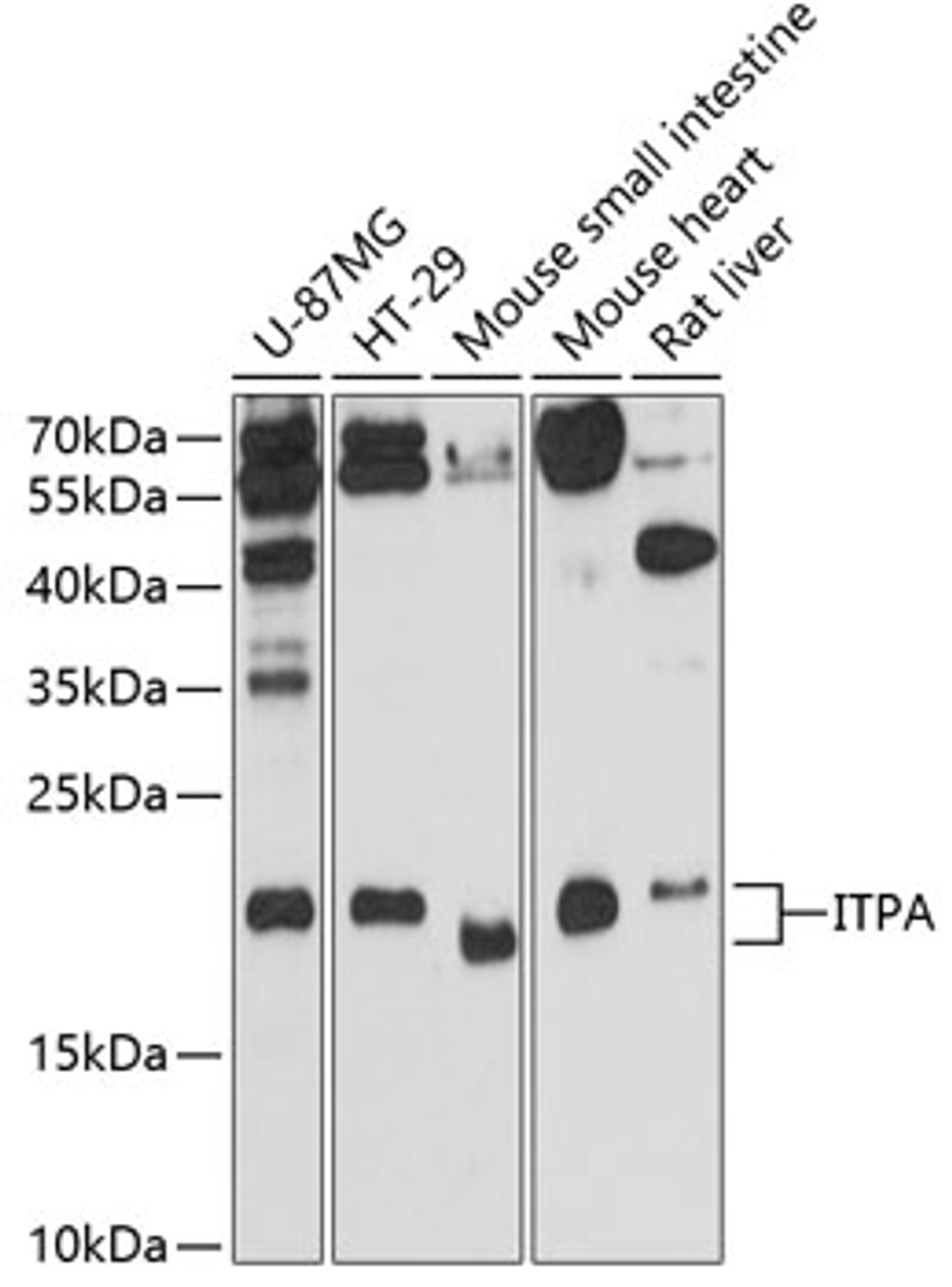 Western blot analysis of extracts of various cell lines, using ITPA antibody (14-317) at 1:3000 dilution.<br/>Secondary antibody: HRP Goat Anti-Rabbit IgG (H+L) at 1:10000 dilution.<br/>Lysates/proteins: 25ug per lane.<br/>Blocking buffer: 3% nonfat dry milk in TBST.<br/>Detection: ECL Enhanced Kit.<br/>Exposure time: 90s.