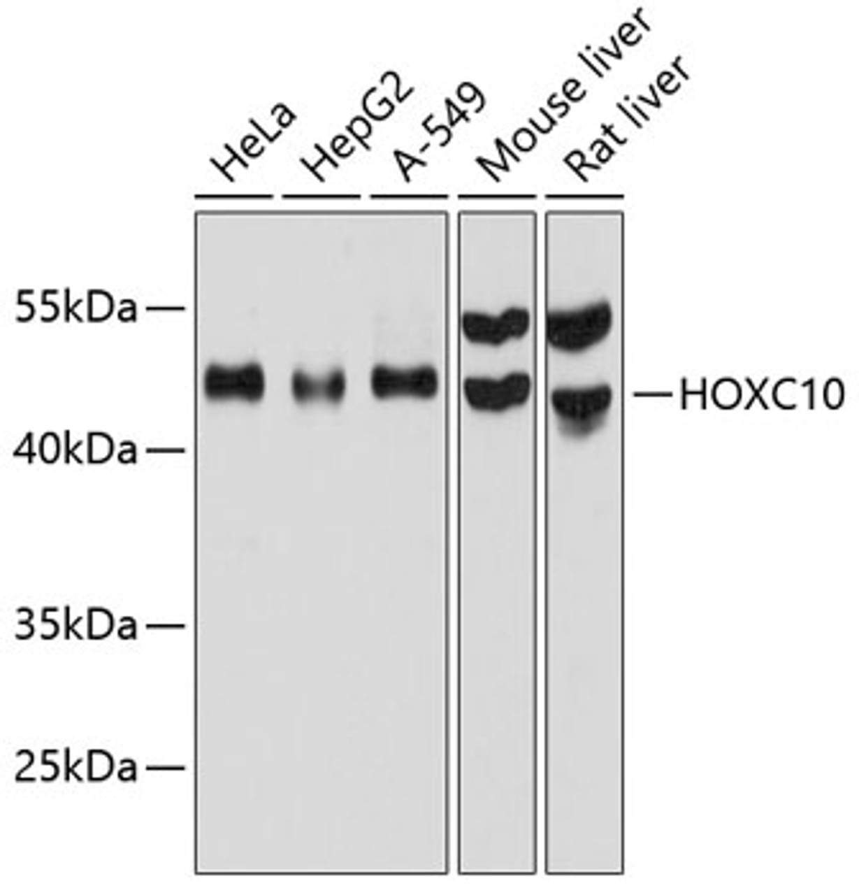 Western blot analysis of extracts of various cell lines, using HOXC10 antibody (14-319) at 1:1000 dilution.<br/>Secondary antibody: HRP Goat Anti-Rabbit IgG (H+L) at 1:10000 dilution.<br/>Lysates/proteins: 25ug per lane.<br/>Blocking buffer: 3% nonfat dry milk in TBST.<br/>Detection: ECL Basic Kit.<br/>Exposure time: 10s.