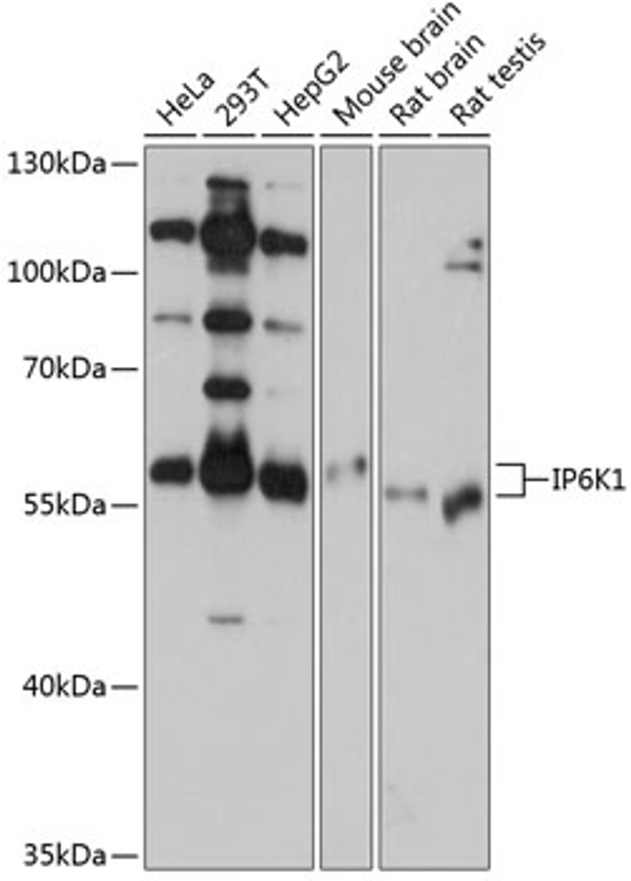 Western blot analysis of extracts of various cell lines, using IP6K1 antibody (14-320) at 1:1000 dilution.<br/>Secondary antibody: HRP Goat Anti-Rabbit IgG (H+L) at 1:10000 dilution.<br/>Lysates/proteins: 25ug per lane.<br/>Blocking buffer: 3% nonfat dry milk in TBST.<br/>Detection: ECL Basic Kit.<br/>Exposure time: 10s.