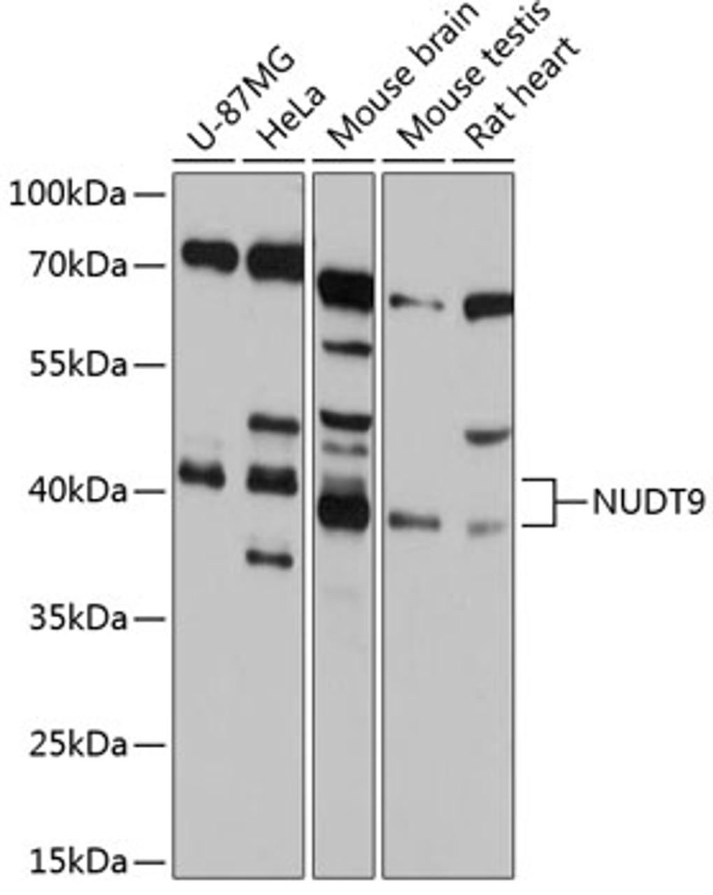Western blot analysis of extracts of various cell lines, using NUDT9 antibody (14-322) at 1:1000 dilution.<br/>Secondary antibody: HRP Goat Anti-Rabbit IgG (H+L) at 1:10000 dilution.<br/>Lysates/proteins: 25ug per lane.<br/>Blocking buffer: 3% nonfat dry milk in TBST.<br/>Detection: ECL Basic Kit.<br/>Exposure time: 10s.