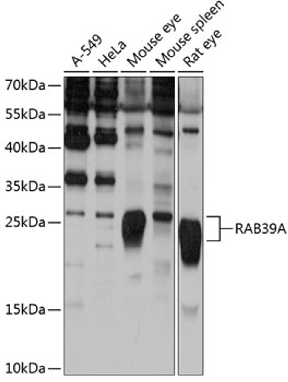 Western blot analysis of extracts of various cell lines, using RAB39A antibody (14-324) at 1:1000 dilution.<br/>Secondary antibody: HRP Goat Anti-Rabbit IgG (H+L) at 1:10000 dilution.<br/>Lysates/proteins: 25ug per lane.<br/>Blocking buffer: 3% nonfat dry milk in TBST.<br/>Detection: ECL Basic Kit.<br/>Exposure time: 10s.