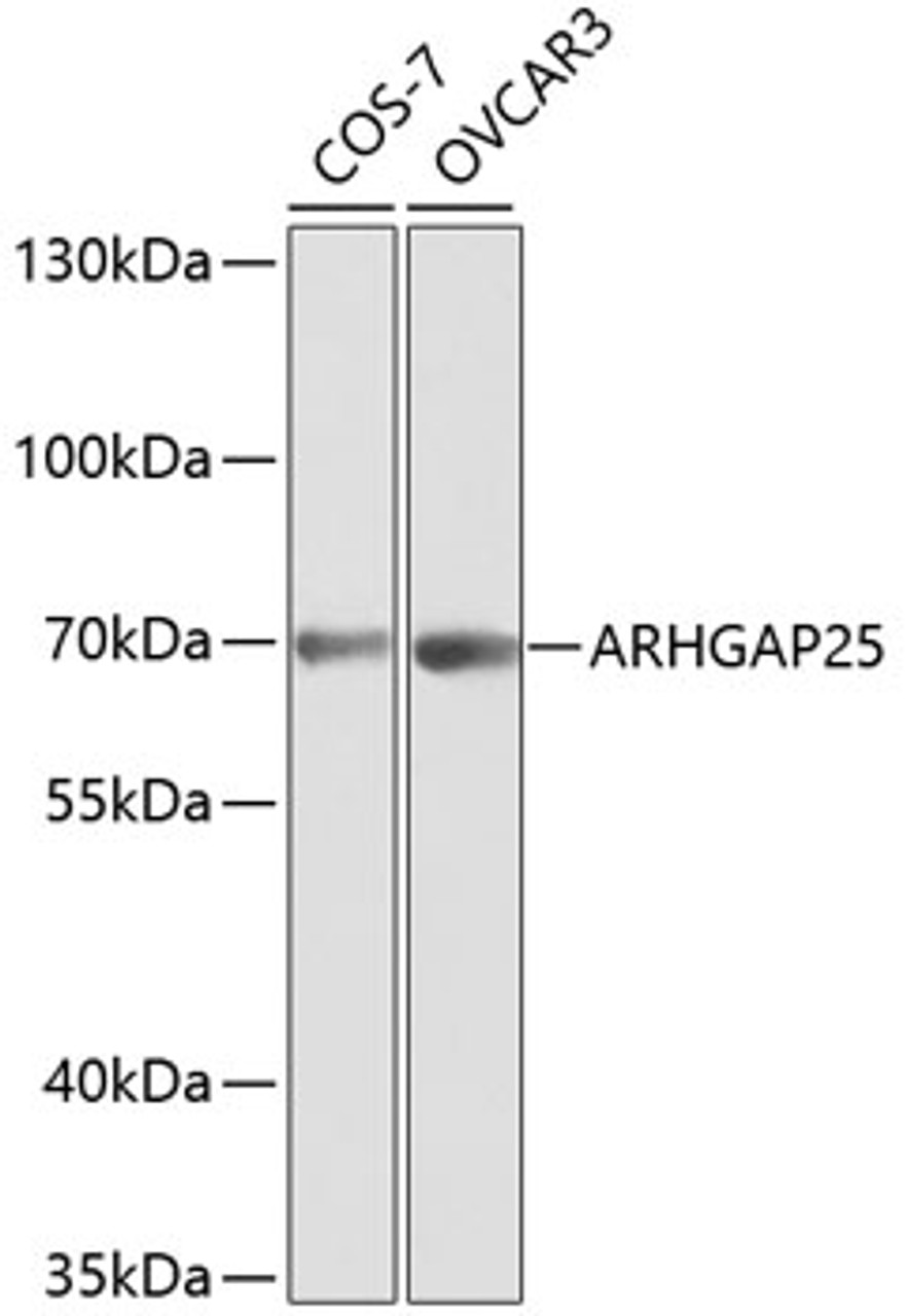 Western blot analysis of extracts of various cell lines, using ARHGAP25 antibody (14-326) at 1:1000 dilution.<br/>Secondary antibody: HRP Goat Anti-Rabbit IgG (H+L) at 1:10000 dilution.<br/>Lysates/proteins: 25ug per lane.<br/>Blocking buffer: 3% nonfat dry milk in TBST.