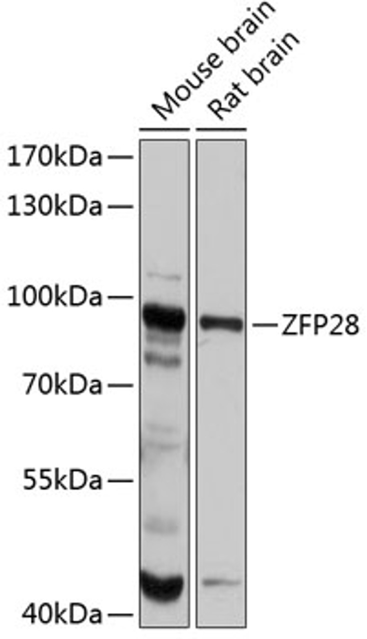 Western blot analysis of extracts of various cell lines, using ZFP28 antibody (14-327) at 1:1000 dilution.<br/>Secondary antibody: HRP Goat Anti-Rabbit IgG (H+L) at 1:10000 dilution.<br/>Lysates/proteins: 25ug per lane.<br/>Blocking buffer: 3% nonfat dry milk in TBST.<br/>Detection: ECL Basic Kit.<br/>Exposure time: 10s.