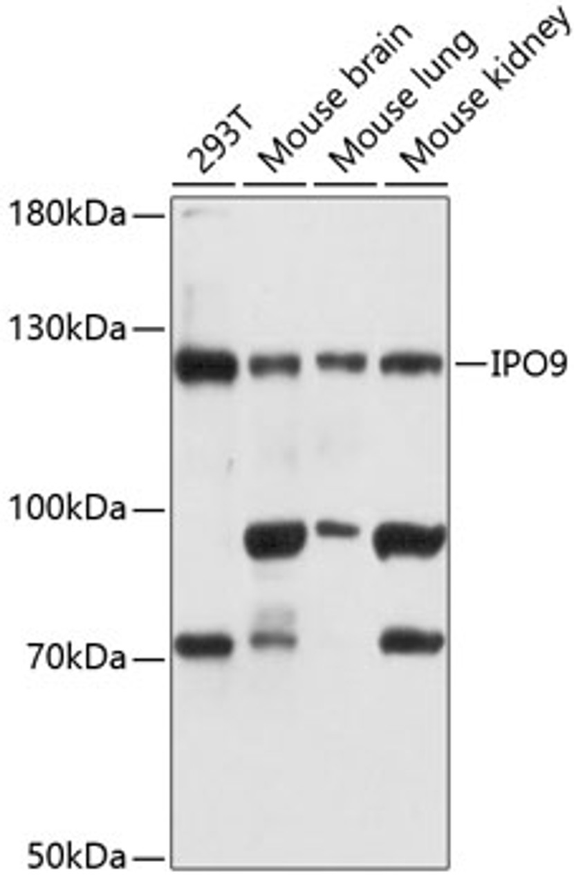 Western blot analysis of extracts of various cell lines, using IPO9 antibody (14-328) at 1:3000 dilution.<br/>Secondary antibody: HRP Goat Anti-Rabbit IgG (H+L) at 1:10000 dilution.<br/>Lysates/proteins: 25ug per lane.<br/>Blocking buffer: 3% nonfat dry milk in TBST.<br/>Detection: ECL Basic Kit.<br/>Exposure time: 5s.