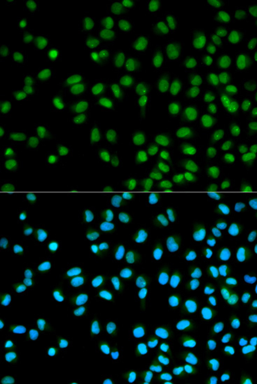 Immunofluorescence analysis of HeLa cells using CST8 antibody (14-329) . Blue: DAPI for nuclear staining.