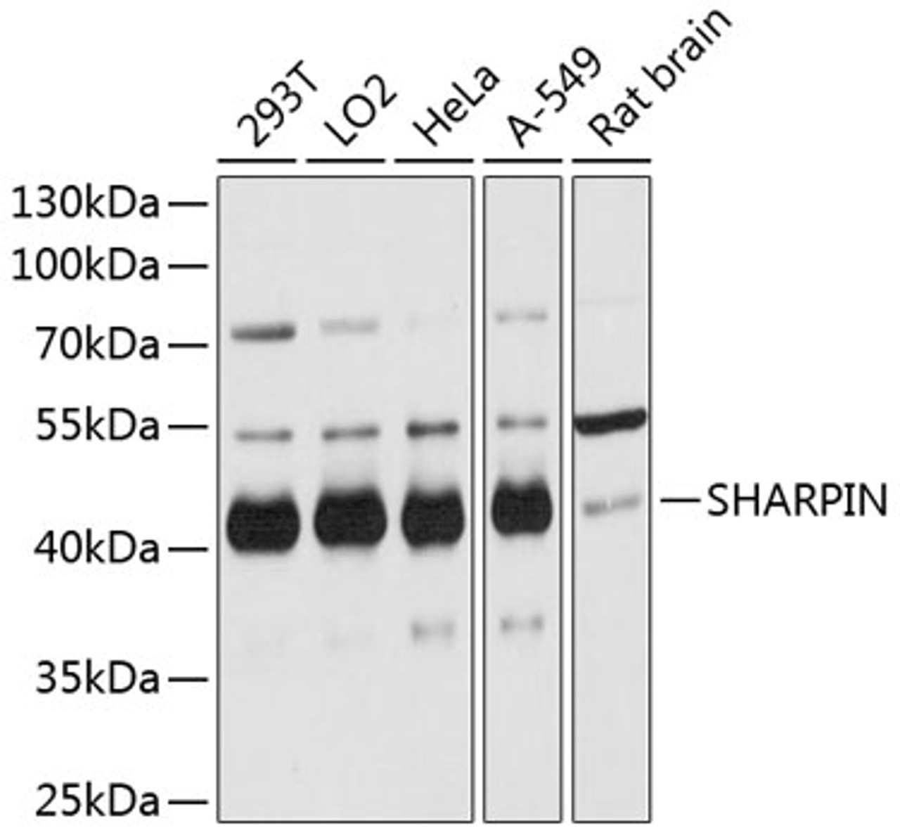 Western blot analysis of extracts of various cell lines, using SHARPIN antibody (14-330) at 1:3000 dilution.<br/>Secondary antibody: HRP Goat Anti-Rabbit IgG (H+L) at 1:10000 dilution.<br/>Lysates/proteins: 25ug per lane.<br/>Blocking buffer: 3% nonfat dry milk in TBST.<br/>Detection: ECL Basic Kit.<br/>Exposure time: 3s.