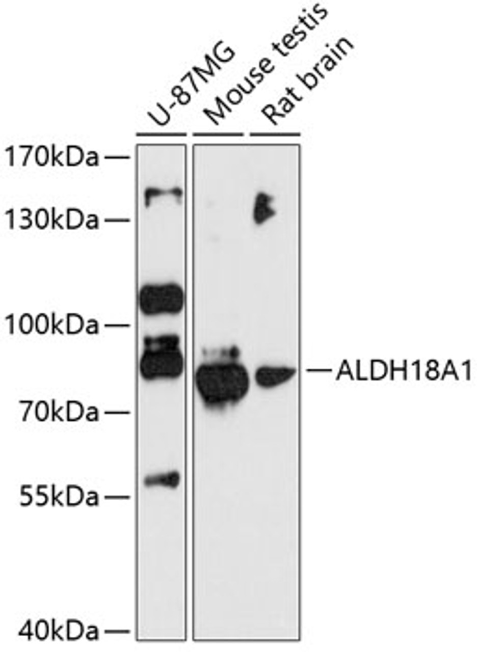 Western blot analysis of extracts of various cell lines, using ALDH18A1 antibody (14-332) at 1:3000 dilution.<br/>Secondary antibody: HRP Goat Anti-Rabbit IgG (H+L) at 1:10000 dilution.<br/>Lysates/proteins: 25ug per lane.<br/>Blocking buffer: 3% nonfat dry milk in TBST.<br/>Detection: ECL Basic Kit.<br/>Exposure time: 90s.