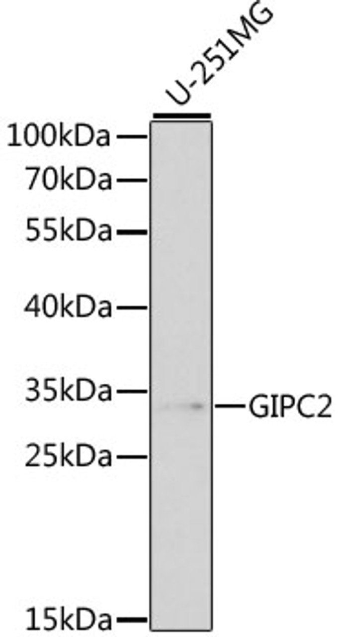 Western blot analysis of extracts of various cell lines, using GIPC2 antibody (14-333) at 1:1000 dilution.<br/>Secondary antibody: HRP Goat Anti-Rabbit IgG (H+L) at 1:10000 dilution.<br/>Lysates/proteins: 25ug per lane.<br/>Blocking buffer: 3% nonfat dry milk in TBST.<br/>Detection: ECL Basic Kit.