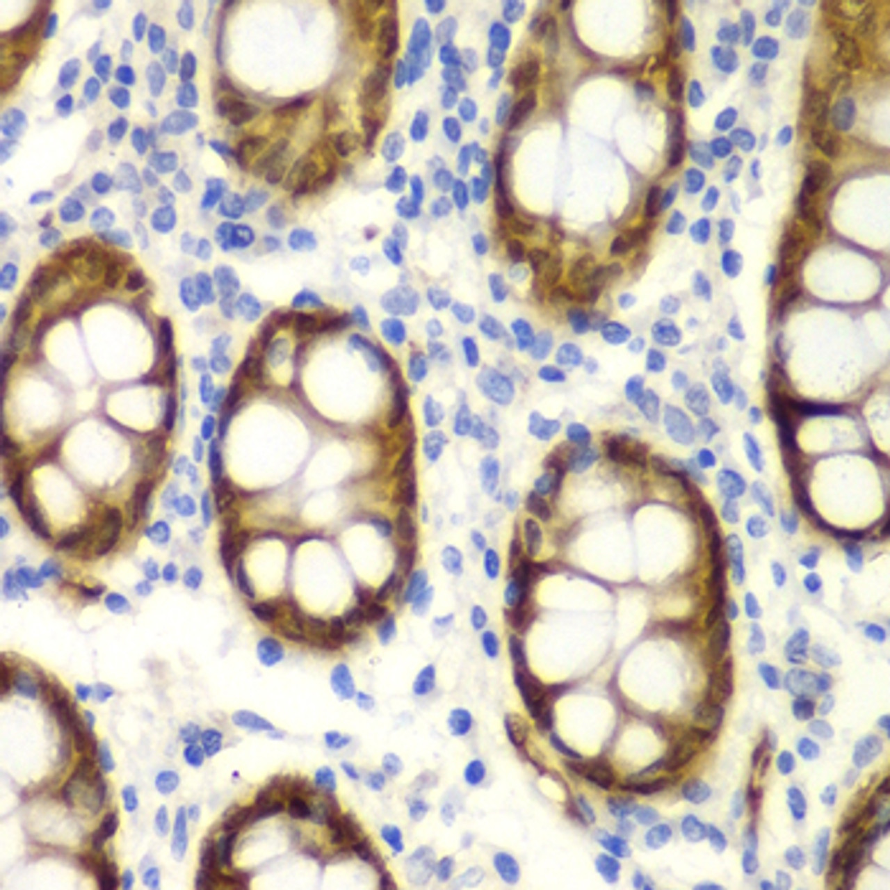 Immunohistochemistry of paraffin-embedded human colon using GIPC2 antibody (14-333) at dilution of 1:100 (40x lens) .