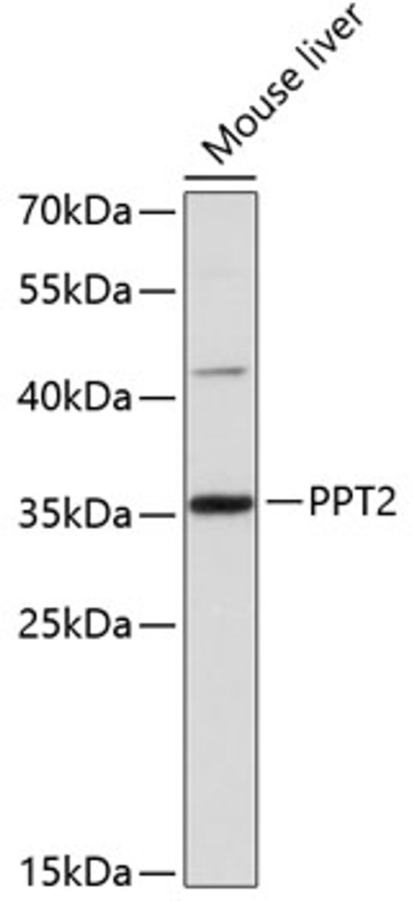 Western blot analysis of extracts of mouse liver, using PPT2 antibody (14-335) at 1:3000 dilution.<br/>Secondary antibody: HRP Goat Anti-Rabbit IgG (H+L) at 1:10000 dilution.<br/>Lysates/proteins: 25ug per lane.<br/>Blocking buffer: 3% nonfat dry milk in TBST.<br/>Detection: ECL Basic Kit.<br/>Exposure time: 90s.