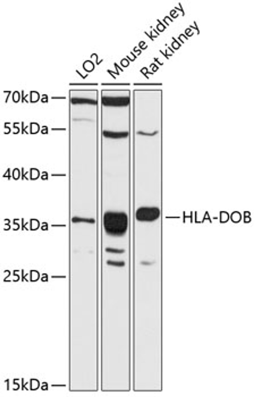 Western blot analysis of extracts of various cell lines, using HLA-DOB antibody (14-338) at 1:3000 dilution.<br/>Secondary antibody: HRP Goat Anti-Rabbit IgG (H+L) at 1:10000 dilution.<br/>Lysates/proteins: 25ug per lane.<br/>Blocking buffer: 3% nonfat dry milk in TBST.<br/>Detection: ECL Basic Kit.<br/>Exposure time: 90s.