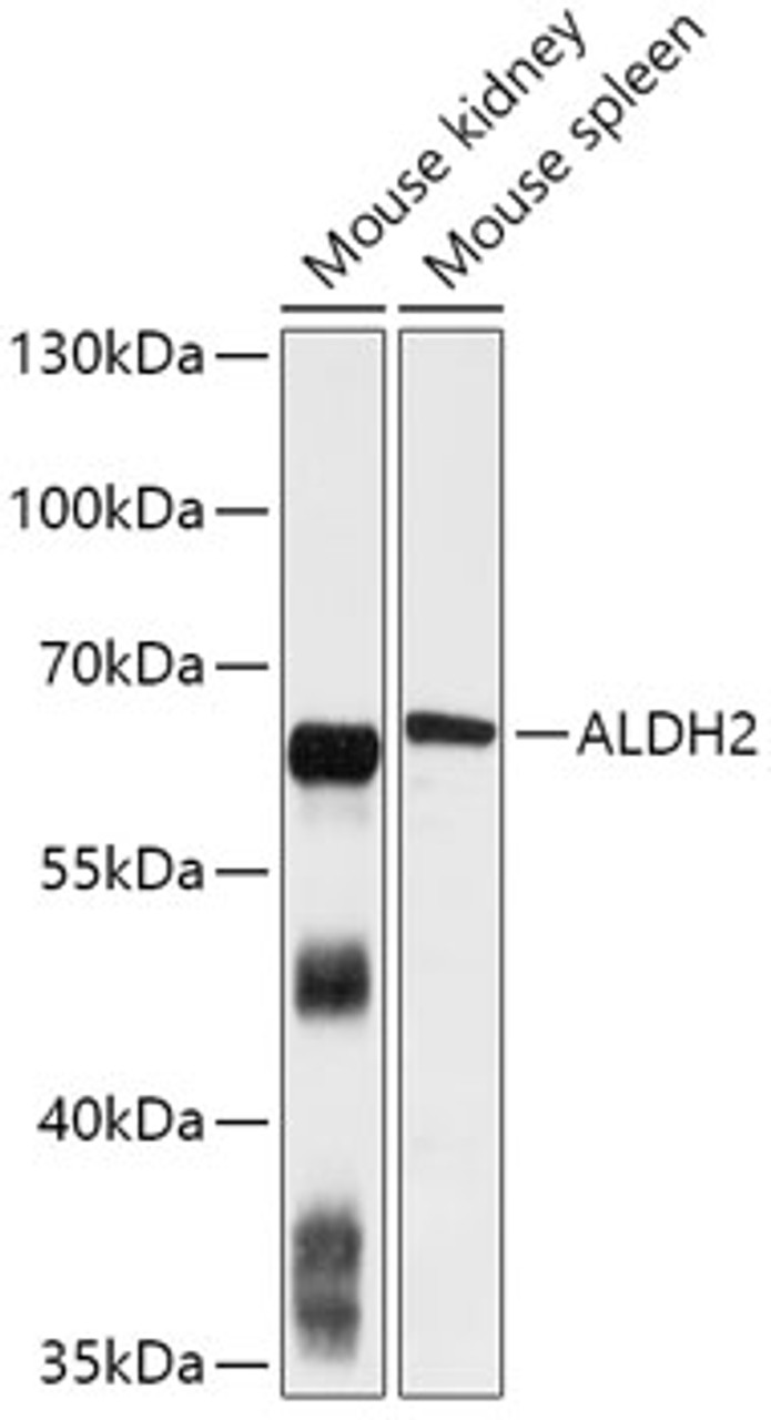 Western blot analysis of extracts of various cell lines, using PRKAA1 antibody (14-346) at 1:1000 dilution.<br/>Secondary antibody: HRP Goat Anti-Rabbit IgG (H+L) at 1:10000 dilution.<br/>Lysates/proteins: 25ug per lane.<br/>Blocking buffer: 3% nonfat dry milk in TBST.<br/>Detection: ECL Basic Kit.<br/>Exposure time: 15s.