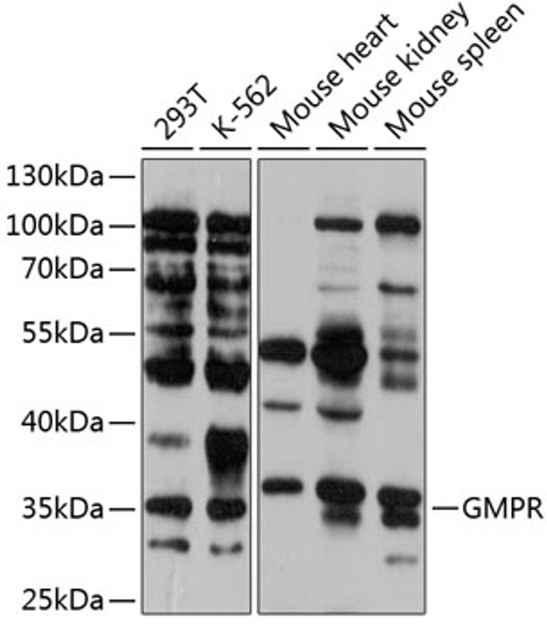 Western blot analysis of extracts of various cell lines, using GMPR antibody (14-347) at 1:1000 dilution.<br/>Secondary antibody: HRP Goat Anti-Rabbit IgG (H+L) at 1:10000 dilution.<br/>Lysates/proteins: 25ug per lane.<br/>Blocking buffer: 3% nonfat dry milk in TBST.<br/>Detection: ECL Basic Kit.<br/>Exposure time: 30s.