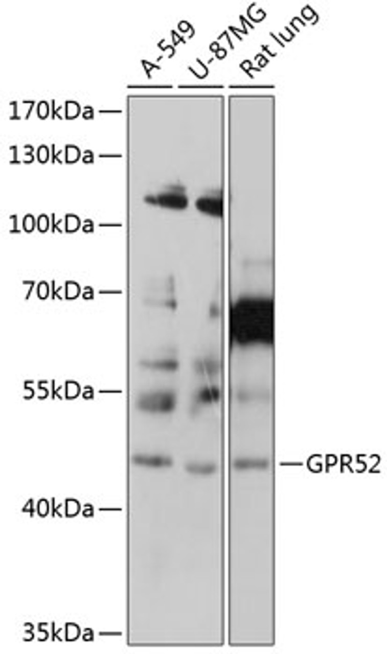 Western blot analysis of extracts of various cell lines, using GPR52 antibody (14-348) at 1:1000 dilution.<br/>Secondary antibody: HRP Goat Anti-Rabbit IgG (H+L) at 1:10000 dilution.<br/>Lysates/proteins: 25ug per lane.<br/>Blocking buffer: 3% nonfat dry milk in TBST.<br/>Detection: ECL Basic Kit.<br/>Exposure time: 10s.