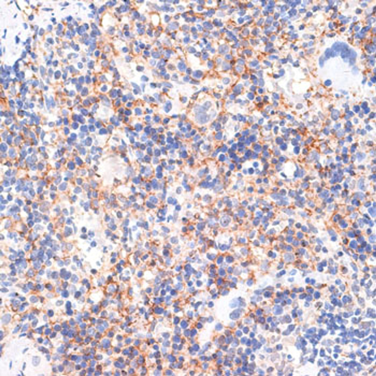 Immunohistochemistry of paraffin-embedded rat spleen using RNF10 antibody (14-349) at dilution of 1:100 (40x lens) .