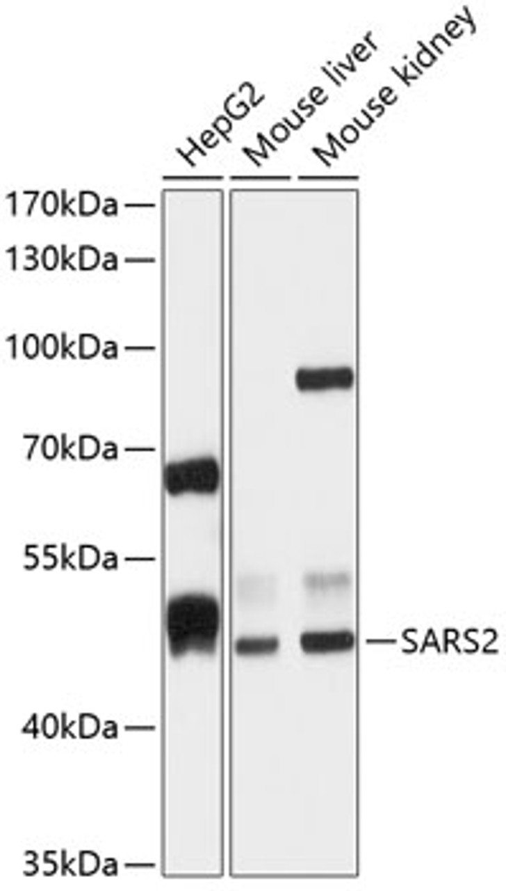 Western blot analysis of extracts of various cell lines, using SARS2 antibody (14-350) at 1:1000 dilution.<br/>Secondary antibody: HRP Goat Anti-Rabbit IgG (H+L) at 1:10000 dilution.<br/>Lysates/proteins: 25ug per lane.<br/>Blocking buffer: 3% nonfat dry milk in TBST.<br/>Detection: ECL Basic Kit.<br/>Exposure time: 10s.