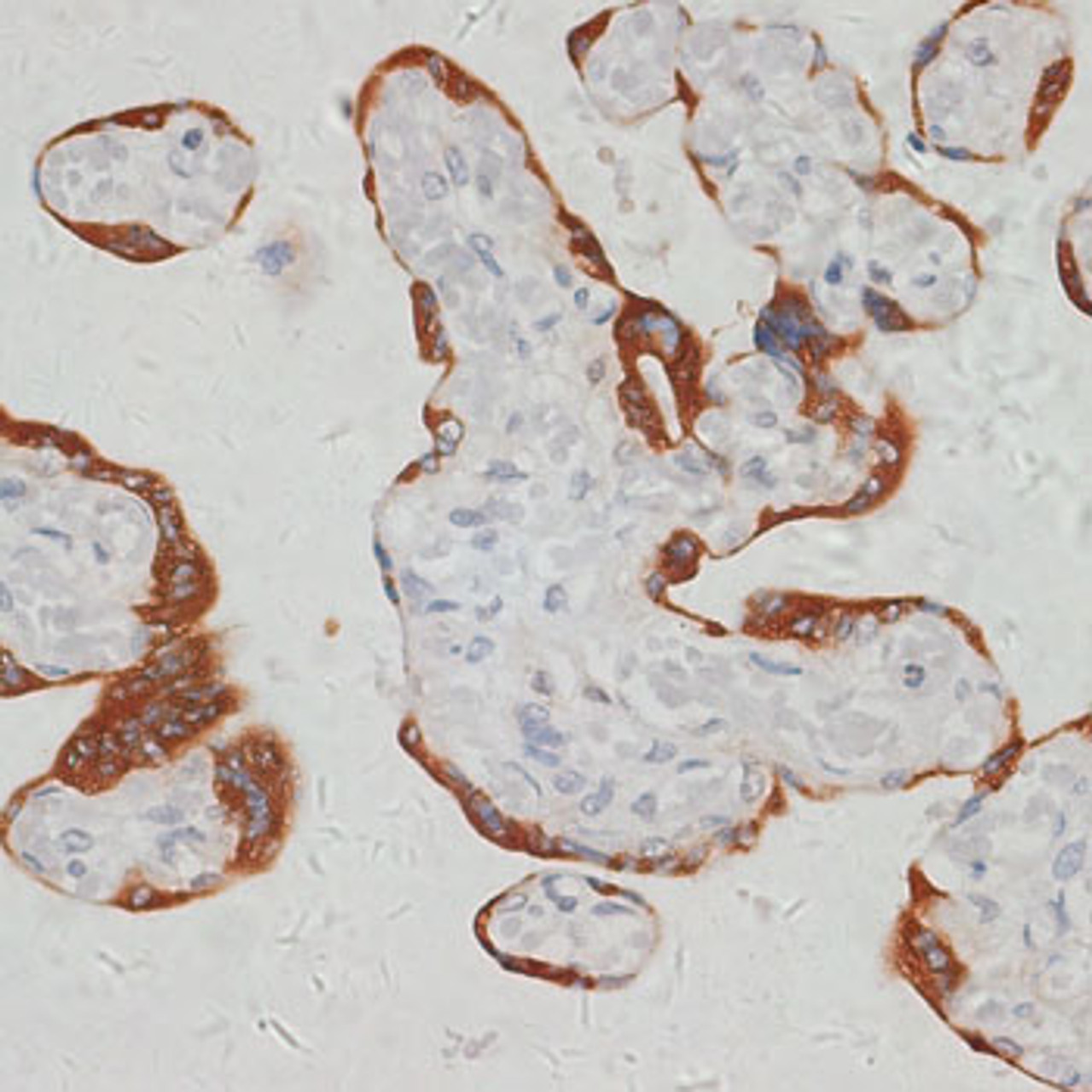 Immunohistochemistry of paraffin-embedded human placenta using SARS2 antibody (14-350) at dilution of 1:100 (40x lens) .