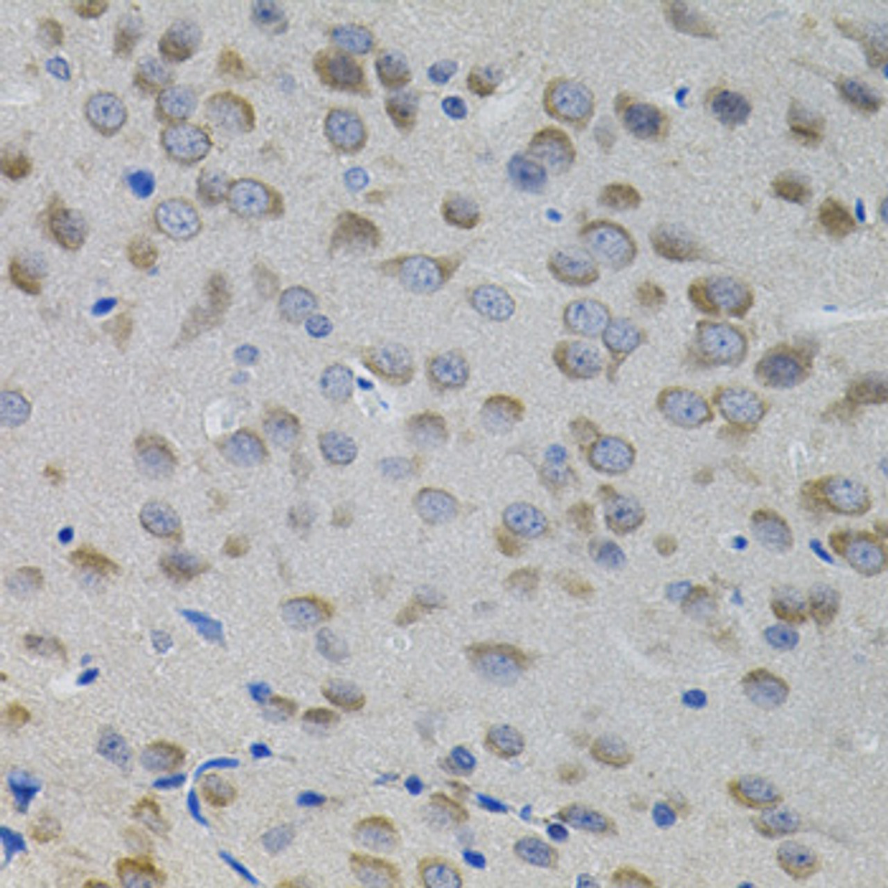 Immunohistochemistry of paraffin-embedded rat brain using SNAI1 antibody (14-354) (40x lens) .