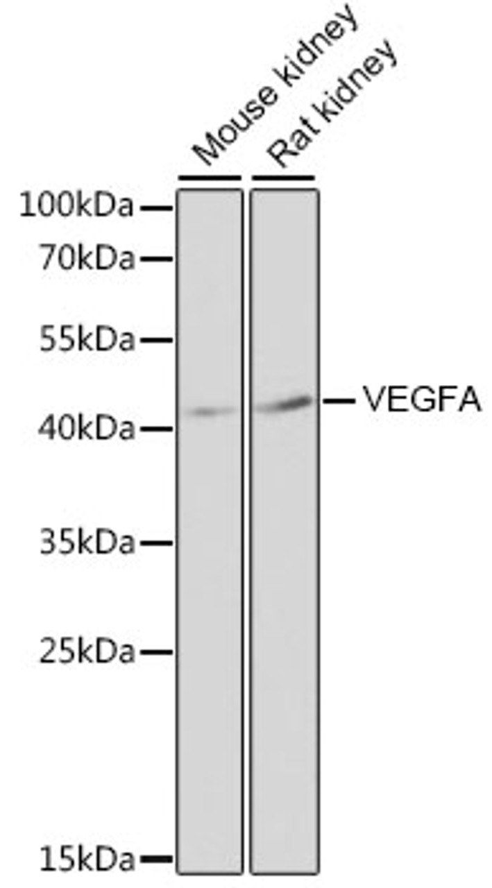 Western blot analysis of extracts of various cell lines, using VEGFA antibody (14-355) at 1:3000 dilution.<br/>Secondary antibody: HRP Goat Anti-Rabbit IgG (H+L) at 1:10000 dilution.<br/>Lysates/proteins: 25ug per lane.<br/>Blocking buffer: 3% nonfat dry milk in TBST.<br/>Detection: ECL Basic Kit.<br/>Exposure time: 30s.
