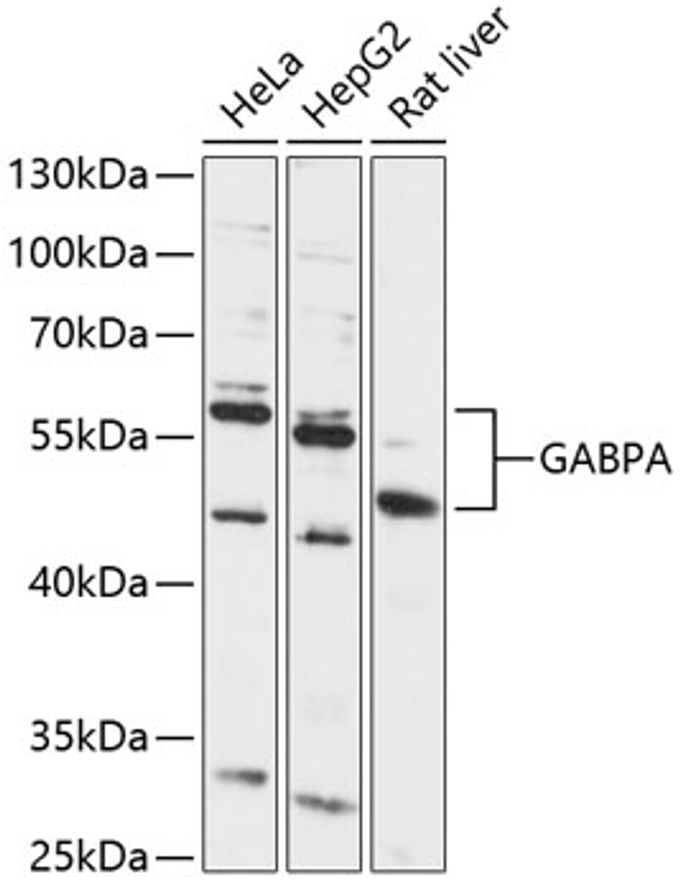 Western blot analysis of extracts of various cell lines, using GABPA antibody (14-357) at 1:1000 dilution.<br/>Secondary antibody: HRP Goat Anti-Rabbit IgG (H+L) at 1:10000 dilution.<br/>Lysates/proteins: 25ug per lane.<br/>Blocking buffer: 3% nonfat dry milk in TBST.<br/>Detection: ECL Basic Kit.<br/>Exposure time: 30s.