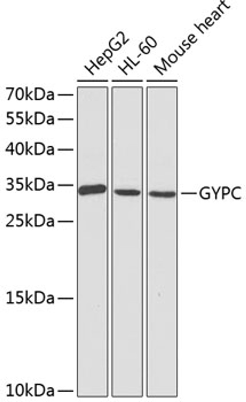 Western blot analysis of extracts of various cell lines, using GYPC antibody (14-362) at 1:1000 dilution.<br/>Secondary antibody: HRP Goat Anti-Rabbit IgG (H+L) at 1:10000 dilution.<br/>Lysates/proteins: 25ug per lane.<br/>Blocking buffer: 3% nonfat dry milk in TBST.<br/>Detection: ECL Basic Kit.<br/>Exposure time: 90s.