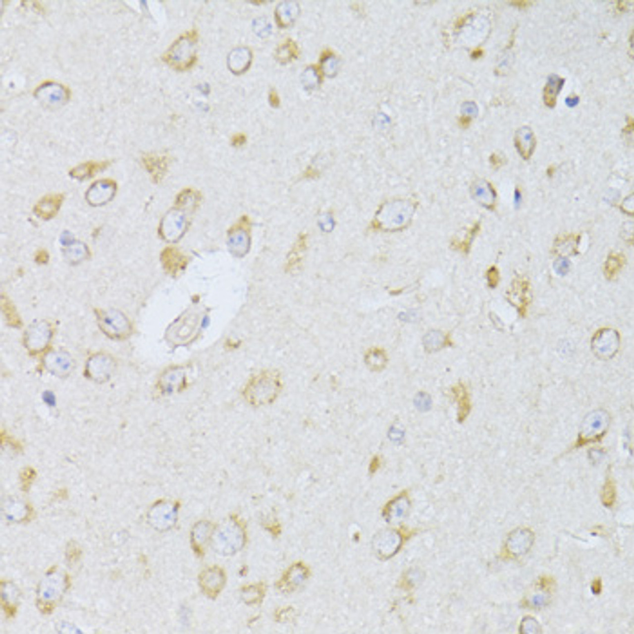 Immunohistochemistry of paraffin-embedded rat brain using NTS antibody (14-365) at dilution of 1:100 (40x lens) .