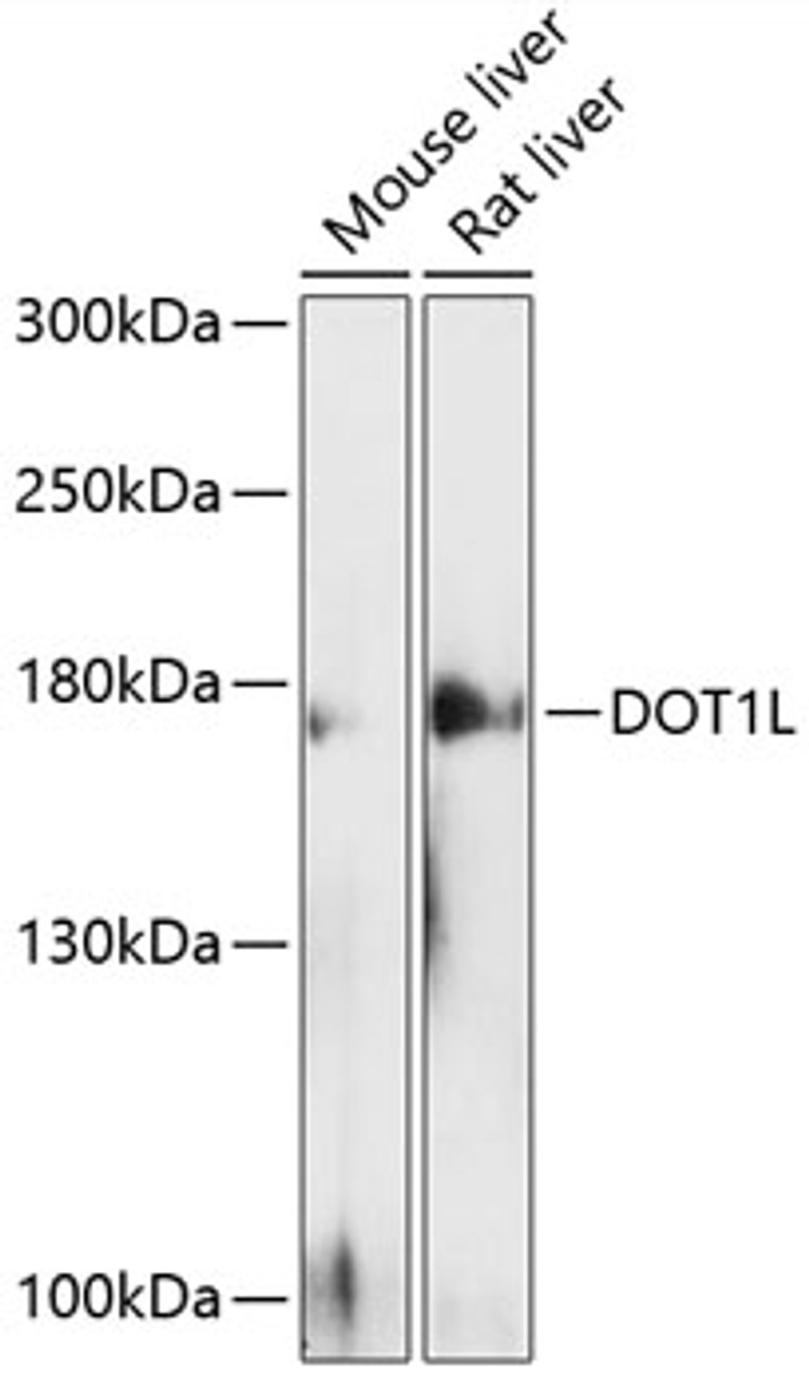 Western blot analysis of extracts of various cell lines, using DOT1L antibody (14-366) at 1:500 dilution.<br/>Secondary antibody: HRP Goat Anti-Rabbit IgG (H+L) at 1:10000 dilution.<br/>Lysates/proteins: 25ug per lane.<br/>Blocking buffer: 3% nonfat dry milk in TBST.<br/>Detection: ECL Enhanced Kit.<br/>Exposure time: 60s.
