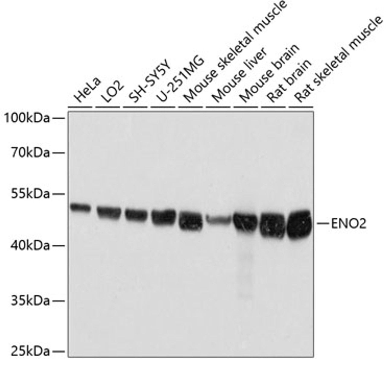 Western blot analysis of extracts of various cell lines, using ENO2 antibody (14-368) at 1:3000 dilution.<br/>Secondary antibody: HRP Goat Anti-Rabbit IgG (H+L) at 1:10000 dilution.<br/>Lysates/proteins: 25ug per lane.<br/>Blocking buffer: 3% nonfat dry milk in TBST.<br/>Detection: ECL Basic Kit.<br/>Exposure time: 1s.