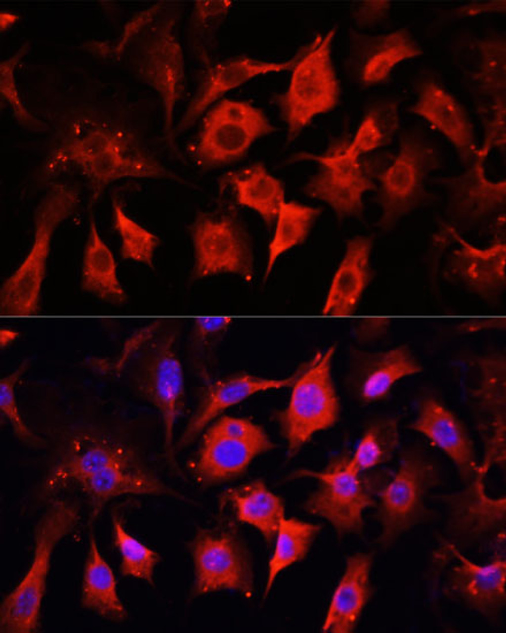 Immunofluorescence analysis of NIH/3T3 cells using ENO2 antibody (14-368) at dilution of 1:100. Blue: DAPI for nuclear staining.