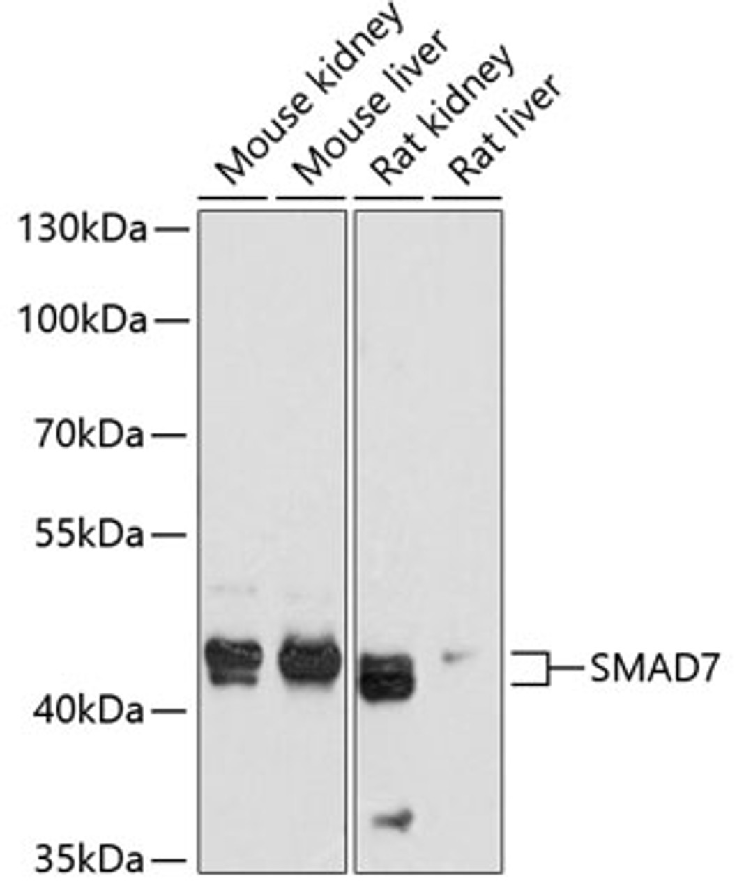 Western blot analysis of extracts of various cell lines, using SMAD7 antibody (14-369) at 1:1000 dilution.<br/>Secondary antibody: HRP Goat Anti-Rabbit IgG (H+L) at 1:10000 dilution.<br/>Lysates/proteins: 25ug per lane.<br/>Blocking buffer: 3% nonfat dry milk in TBST.<br/>Detection: ECL Basic Kit.<br/>Exposure time: 90s.