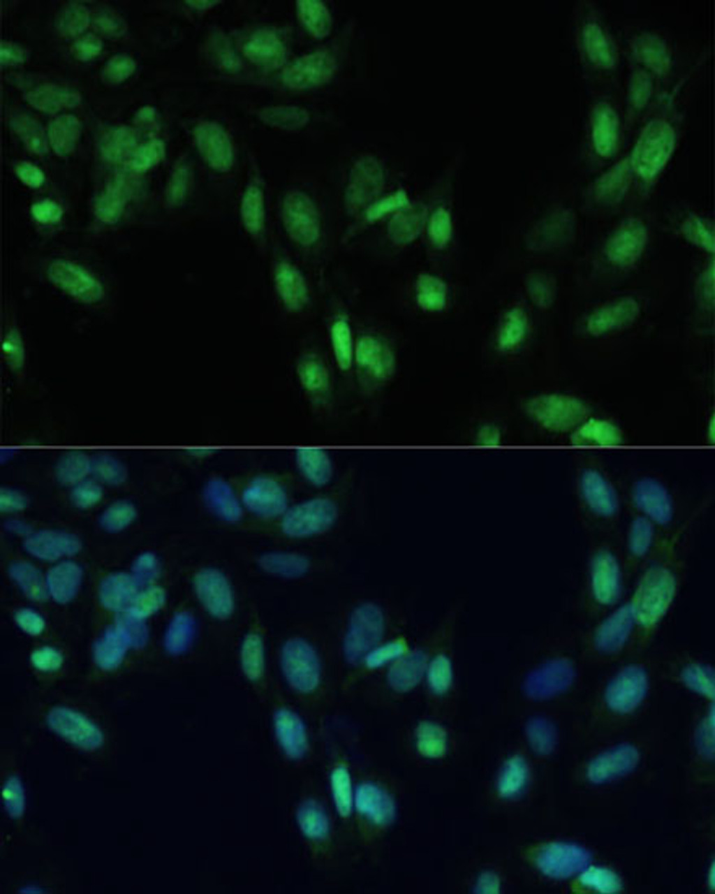 Immunofluorescence analysis of U2OS cells using SMAD7 antibody (14-369) at dilution of 1:100. Blue: DAPI for nuclear staining.