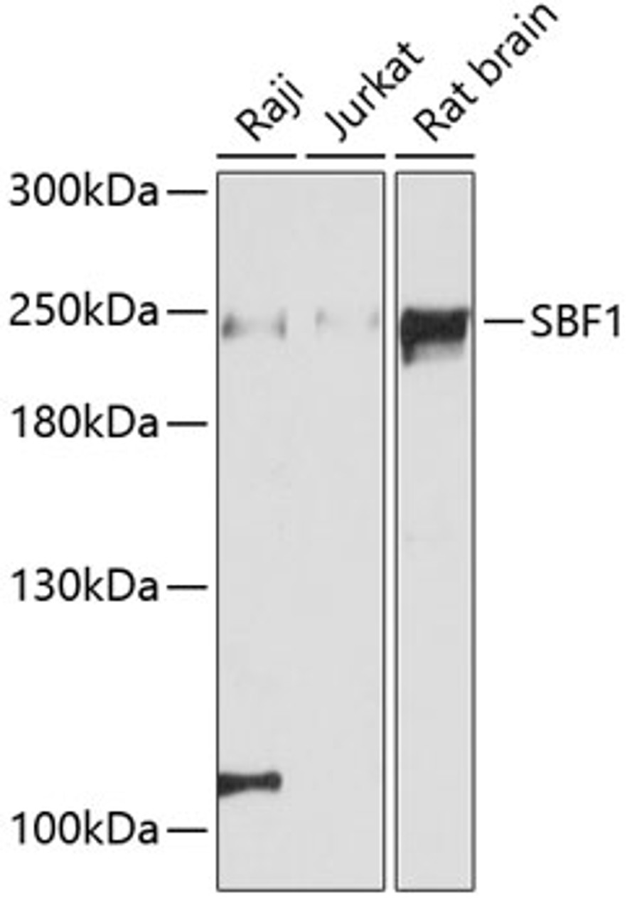 Western blot analysis of extracts of various cell lines, using SBF1 antibody (14-374) at 1:3000 dilution.<br/>Secondary antibody: HRP Goat Anti-Rabbit IgG (H+L) at 1:10000 dilution.<br/>Lysates/proteins: 25ug per lane.<br/>Blocking buffer: 3% nonfat dry milk in TBST.<br/>Detection: ECL Basic Kit.<br/>Exposure time: 90s.