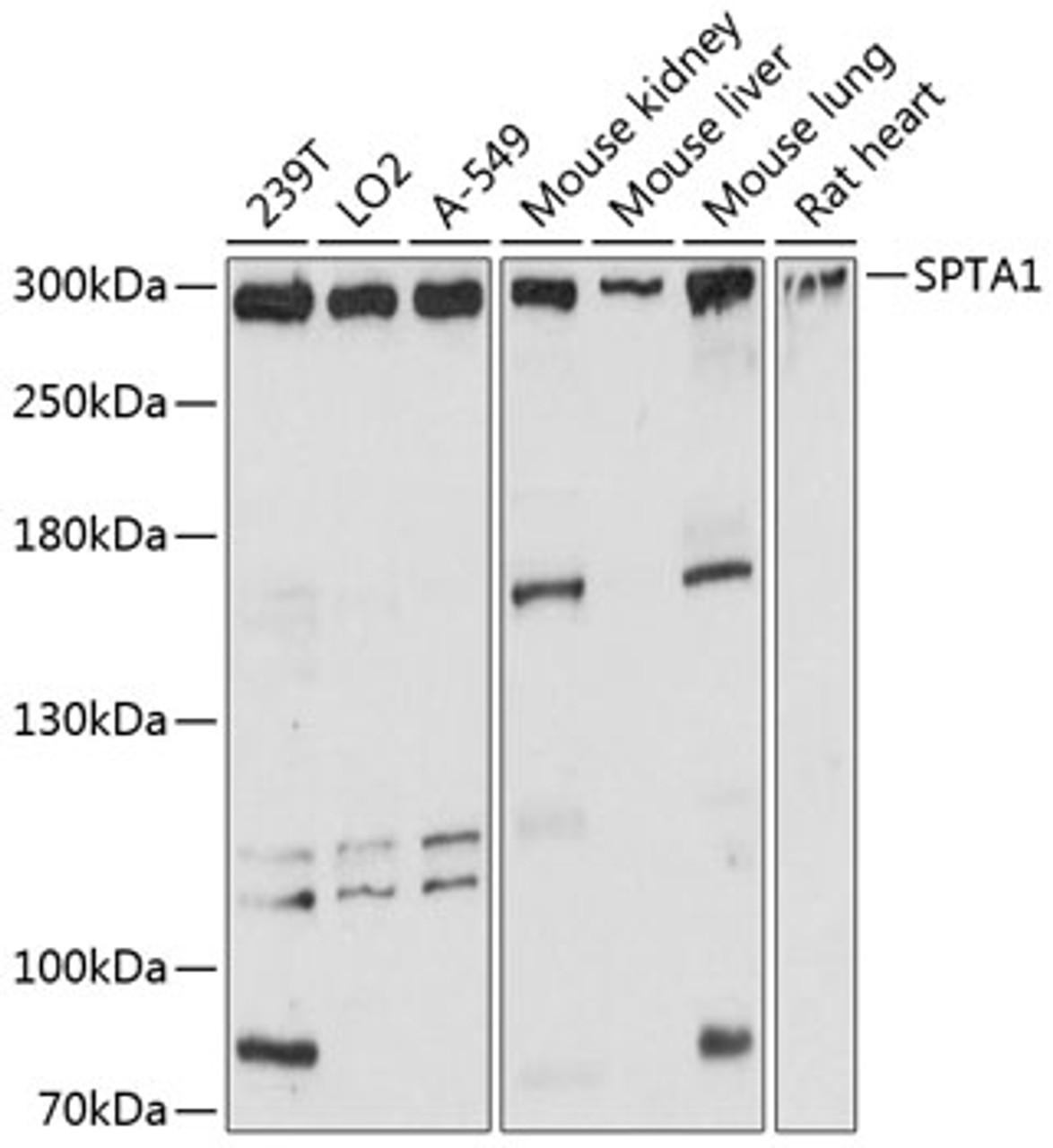 Western blot analysis of extracts of various cell lines, using SPTA1 antibody (14-375) at 1:3000 dilution.<br/>Secondary antibody: HRP Goat Anti-Rabbit IgG (H+L) at 1:10000 dilution.<br/>Lysates/proteins: 25ug per lane.<br/>Blocking buffer: 3% nonfat dry milk in TBST.<br/>Detection: ECL Basic Kit.<br/>Exposure time: 10s.