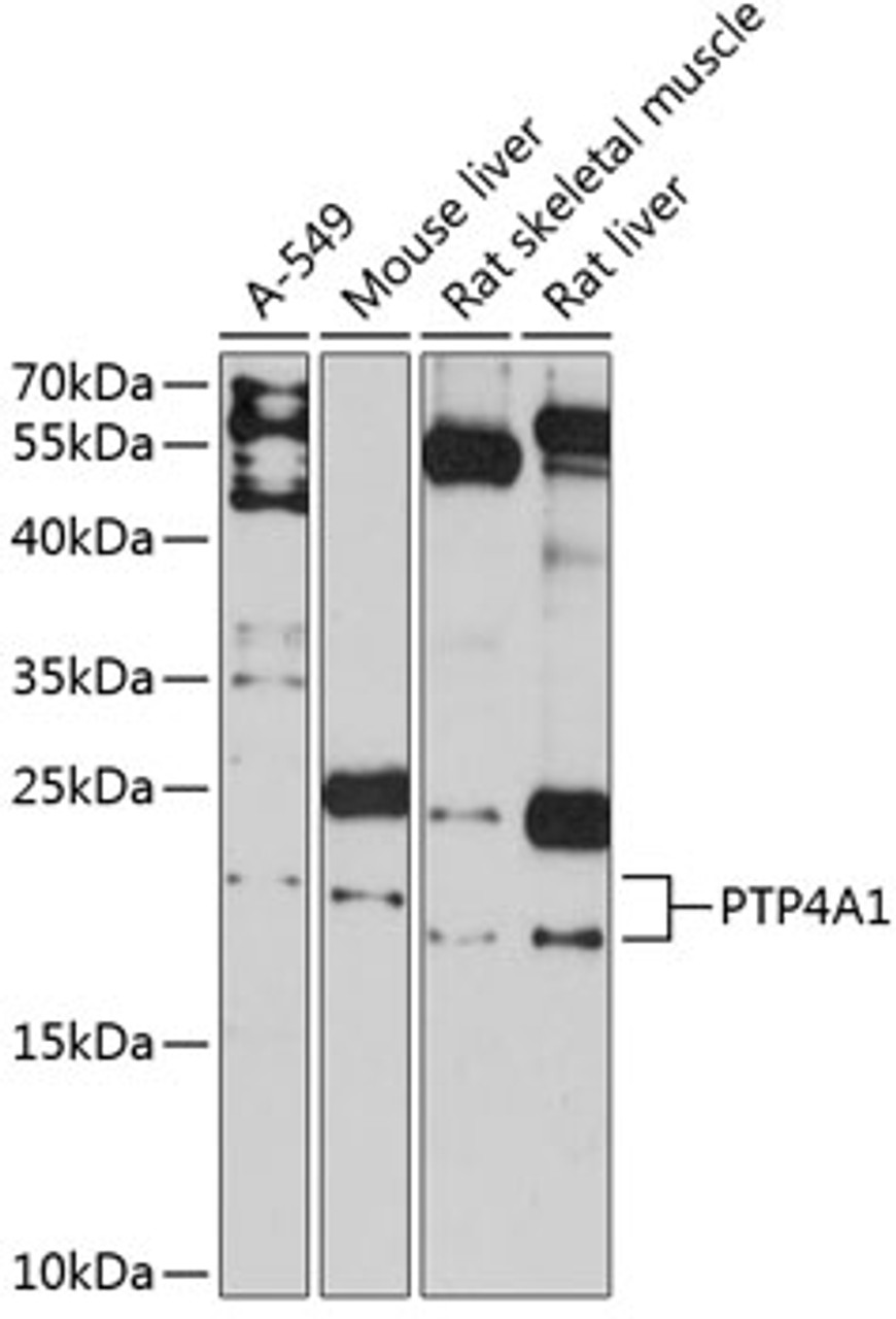 Western blot analysis of extracts of various cell lines, using PTP4A1 antibody (14-378) at 1:3000 dilution.<br/>Secondary antibody: HRP Goat Anti-Rabbit IgG (H+L) at 1:10000 dilution.<br/>Lysates/proteins: 25ug per lane.<br/>Blocking buffer: 3% nonfat dry milk in TBST.<br/>Detection: ECL Basic Kit.<br/>Exposure time: 90s.