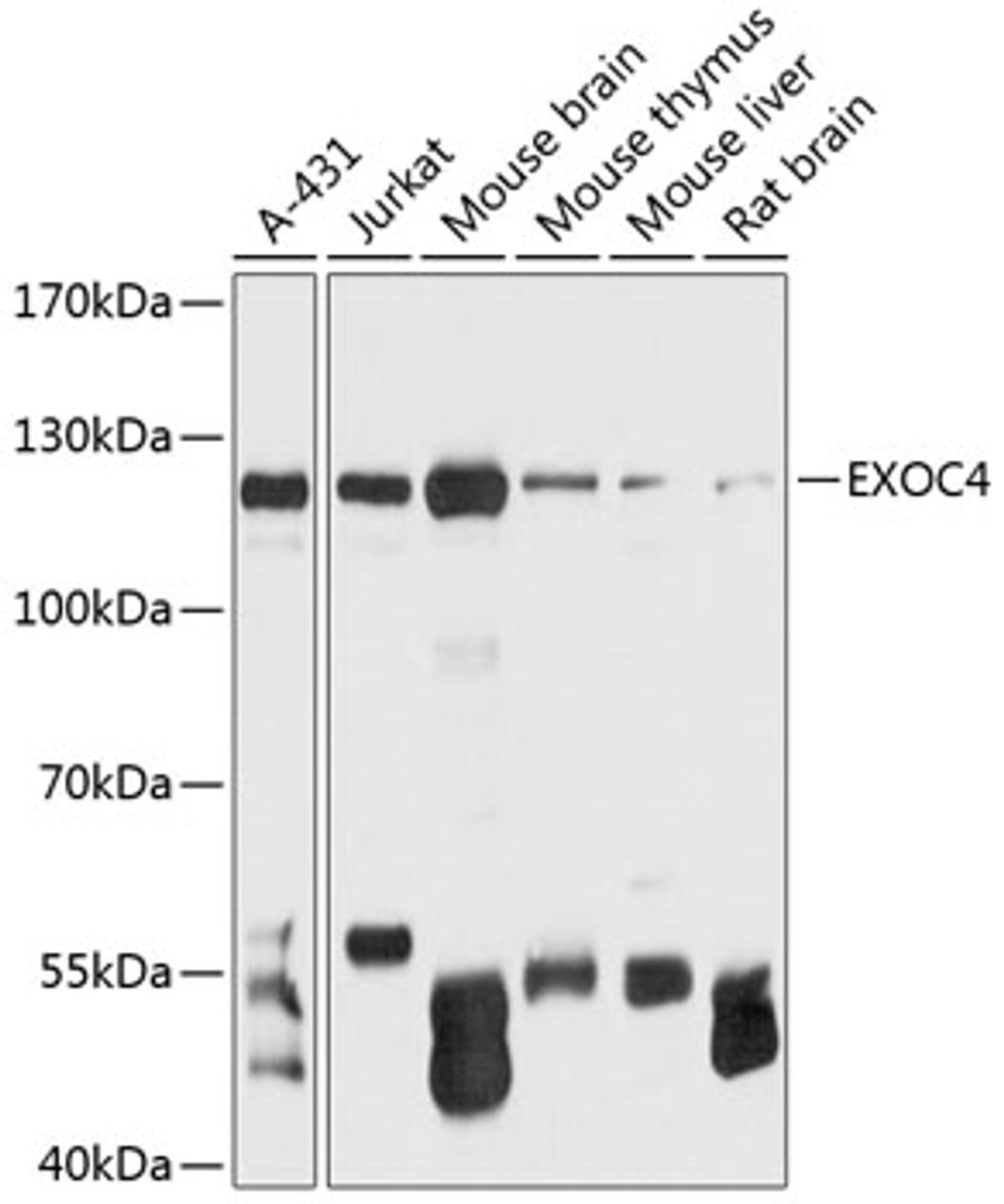 Western blot analysis of extracts of various cell lines, using EXOC4 antibody (14-383) at 1:3000 dilution.<br/>Secondary antibody: HRP Goat Anti-Rabbit IgG (H+L) at 1:10000 dilution.<br/>Lysates/proteins: 25ug per lane.<br/>Blocking buffer: 3% nonfat dry milk in TBST.<br/>Detection: ECL Basic Kit.<br/>Exposure time: 1s.